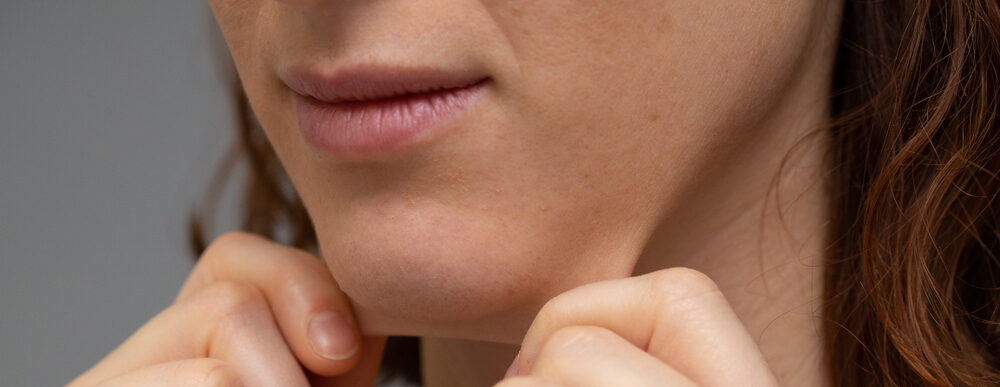 Flacidez Facial - Luiza Hoscheidt - Fisioterapia Dermatofuncional - Porto Alegre