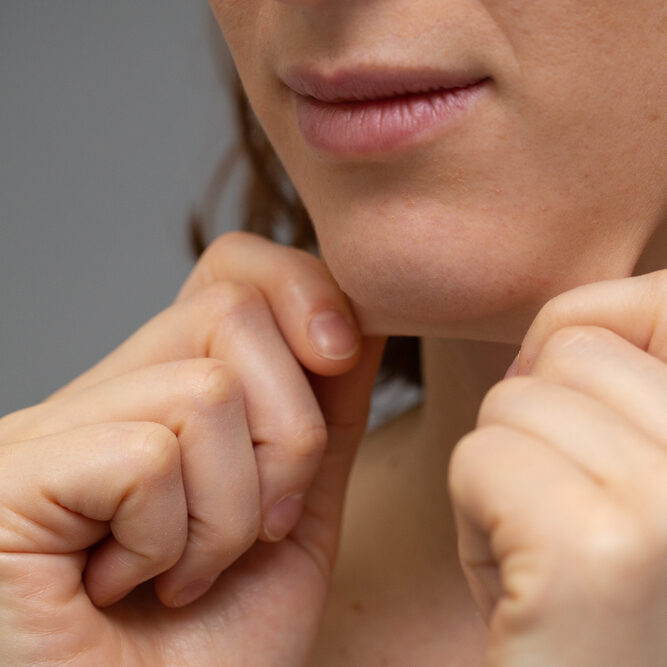 Flacidez Facial - Luiza Hoscheidt - Fisioterapia Dermatofuncional - Porto Alegre